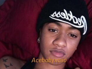 Acebabyxoxo