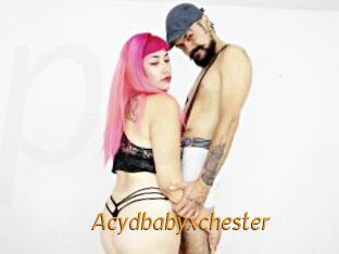 Acydbabyxchester