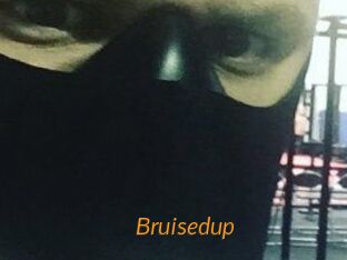 Bruisedup