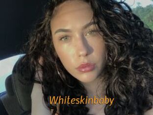 Whiteskinbaby